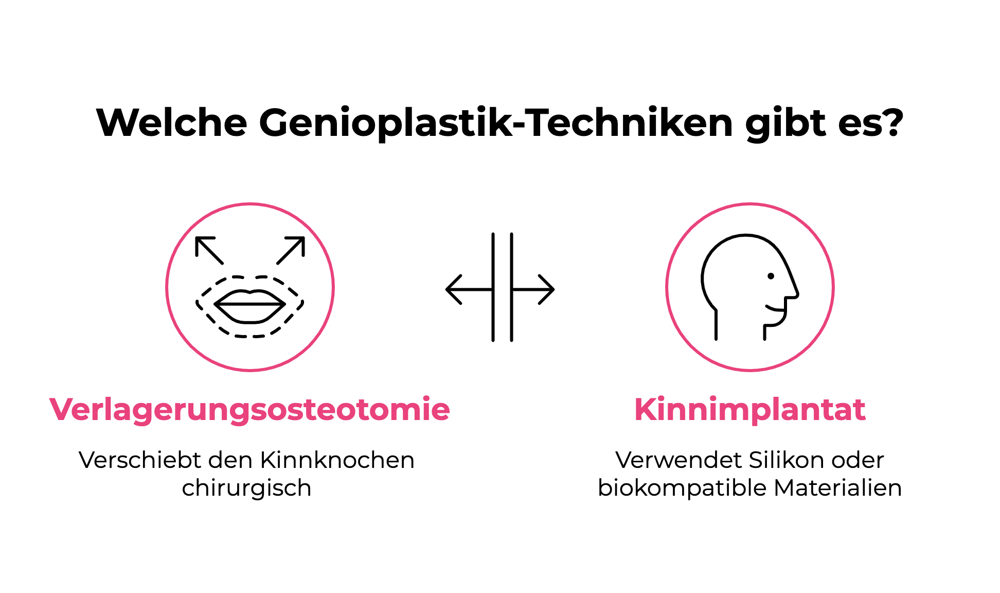 Vergleich der Techniken bei Genioplastik: Sliding Genioplasty vs. Kinnimplantat