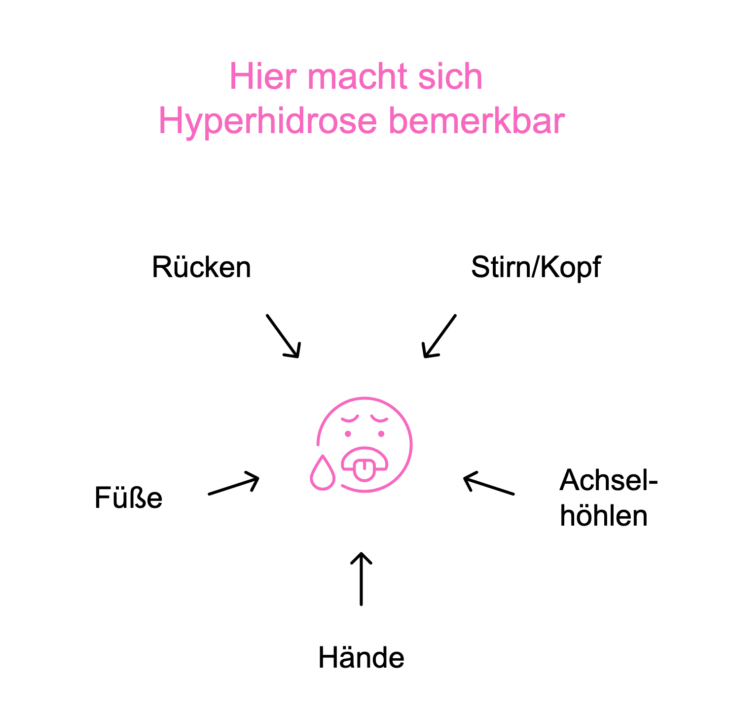 Körperstellen, die von Hyperhidrose betroffen sein können