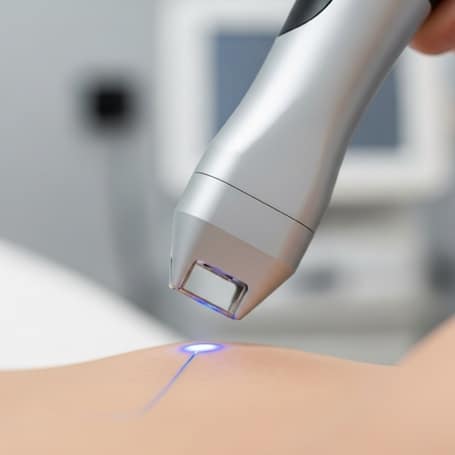 Ablation