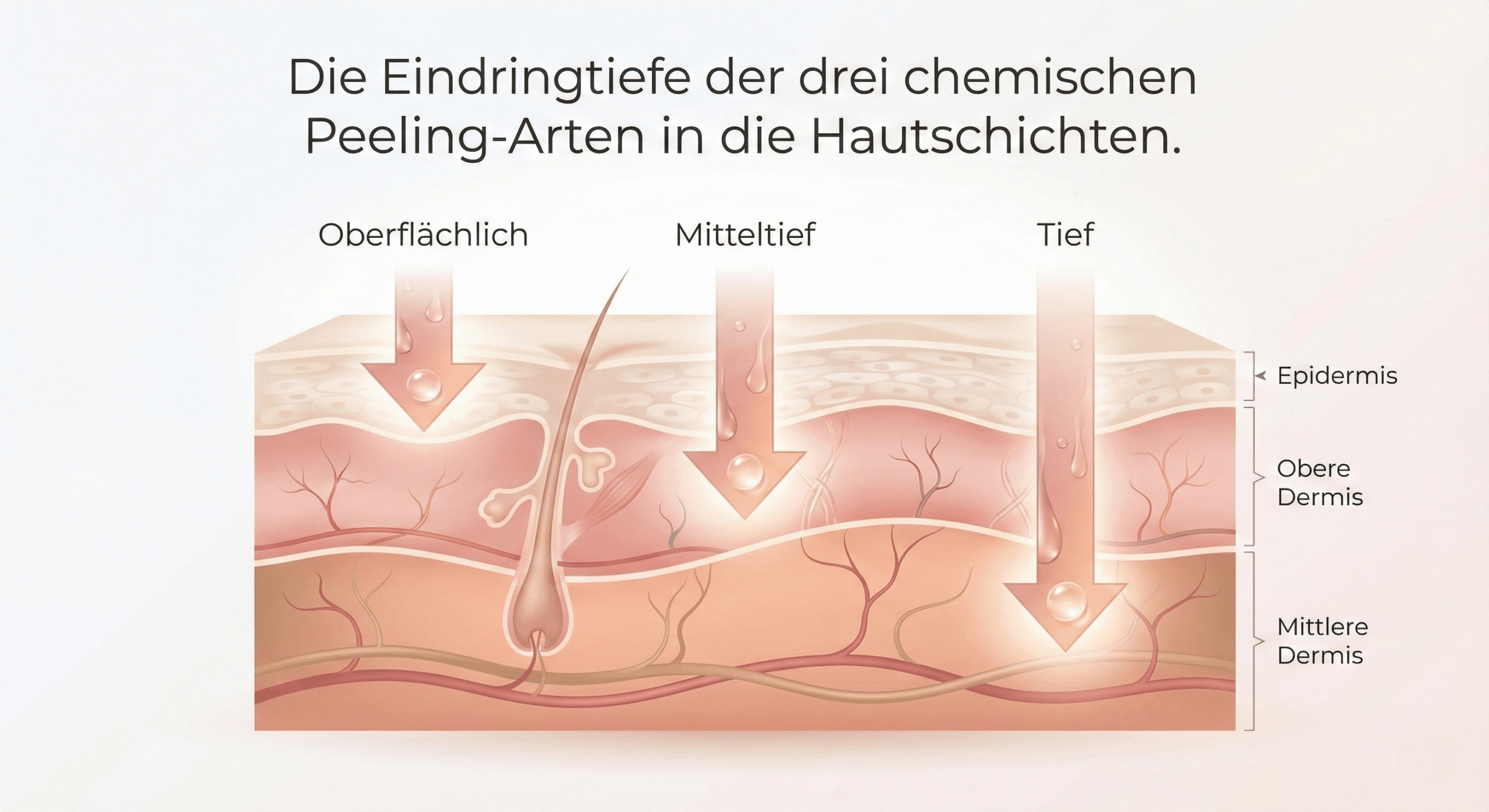 Chemical Peeling Arten