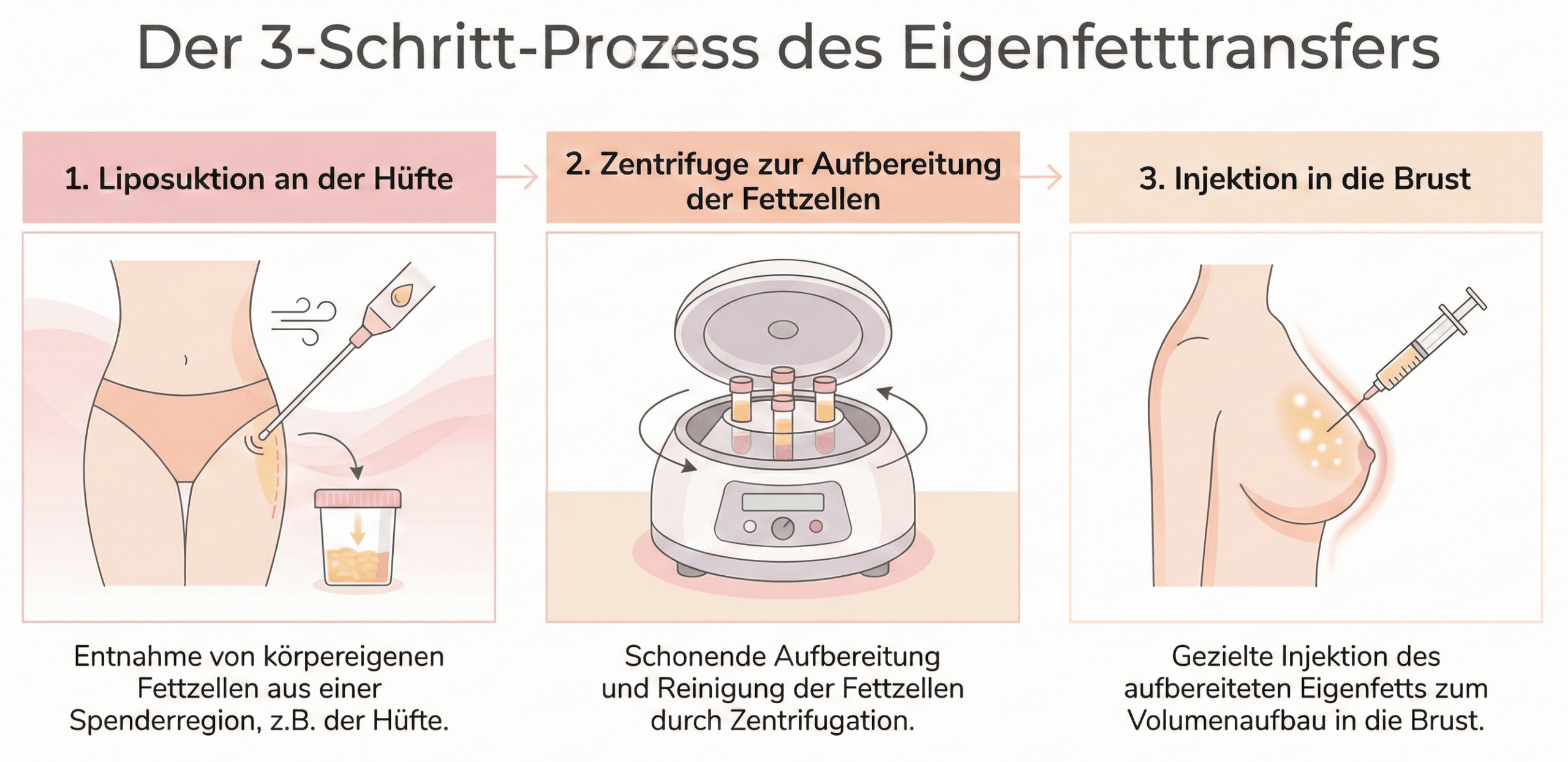 Grafik: Eigenfetttransfer-Prozess
