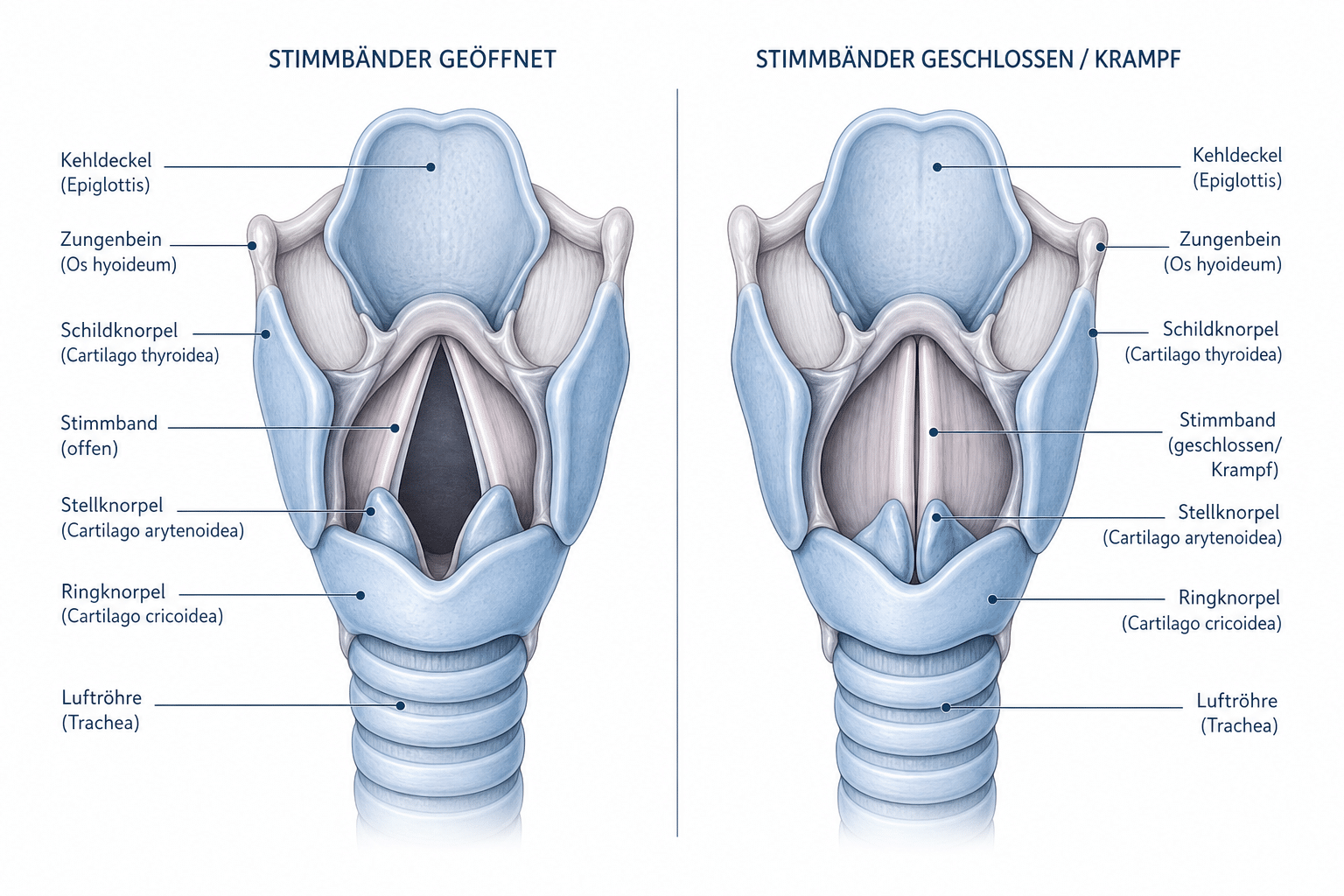 Anatomische Darstellung des Kehlkopfes mit Stimmritze: Visualisierung des Laryngospasmus bei Narkose