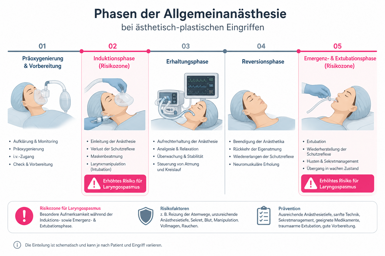Zeitstrahl einer Schönheitsoperation unter Narkose mit hervorgehobenen Risikophasen für einen Laryngospasmus.